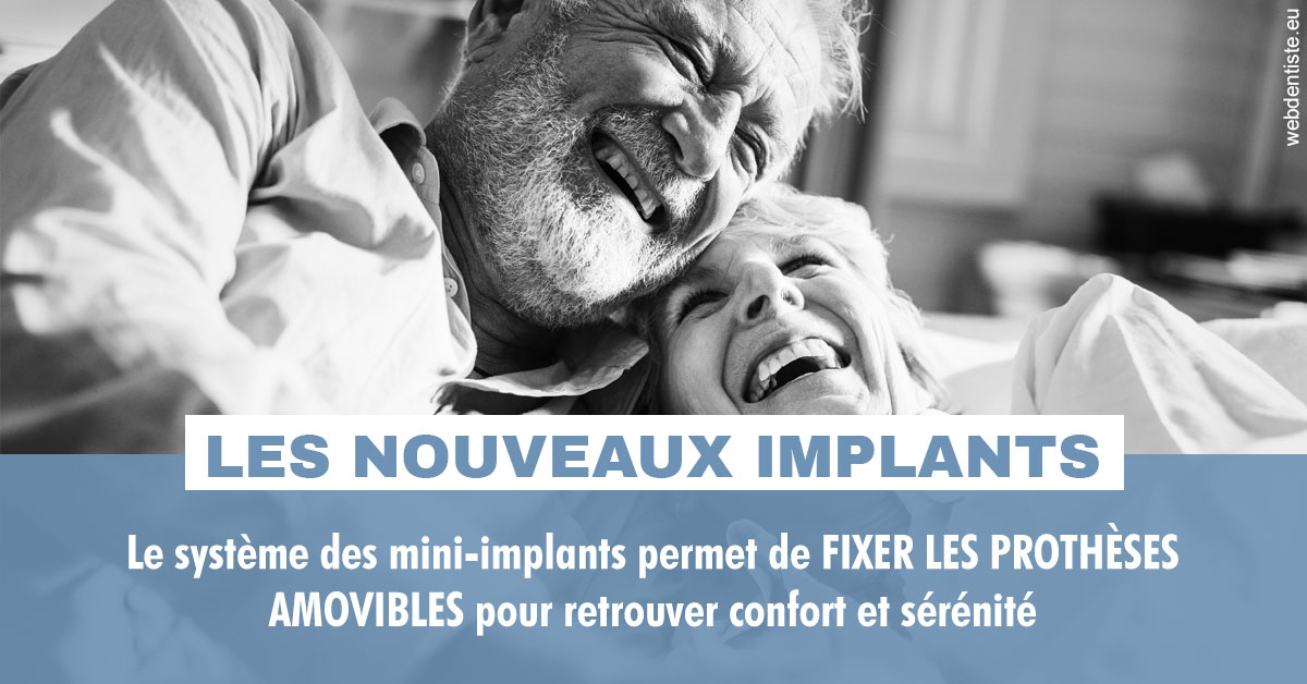 https://www.drlaparra.fr/Les nouveaux implants 2