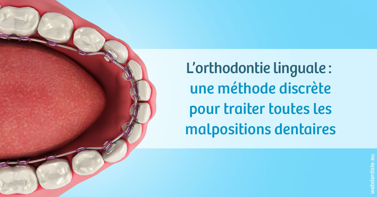 https://www.drlaparra.fr/L'orthodontie linguale 1