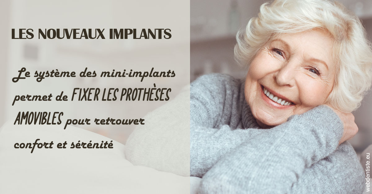https://www.drlaparra.fr/Les nouveaux implants 1