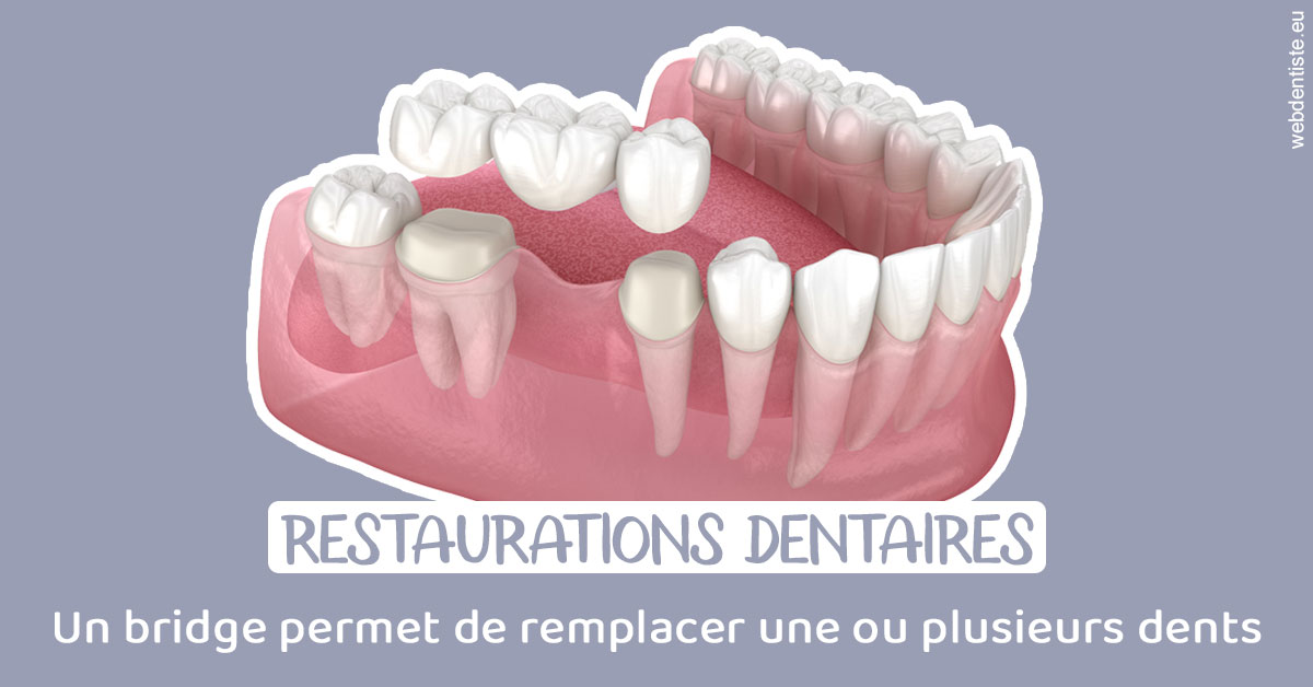 https://www.drlaparra.fr/Bridge remplacer dents 1