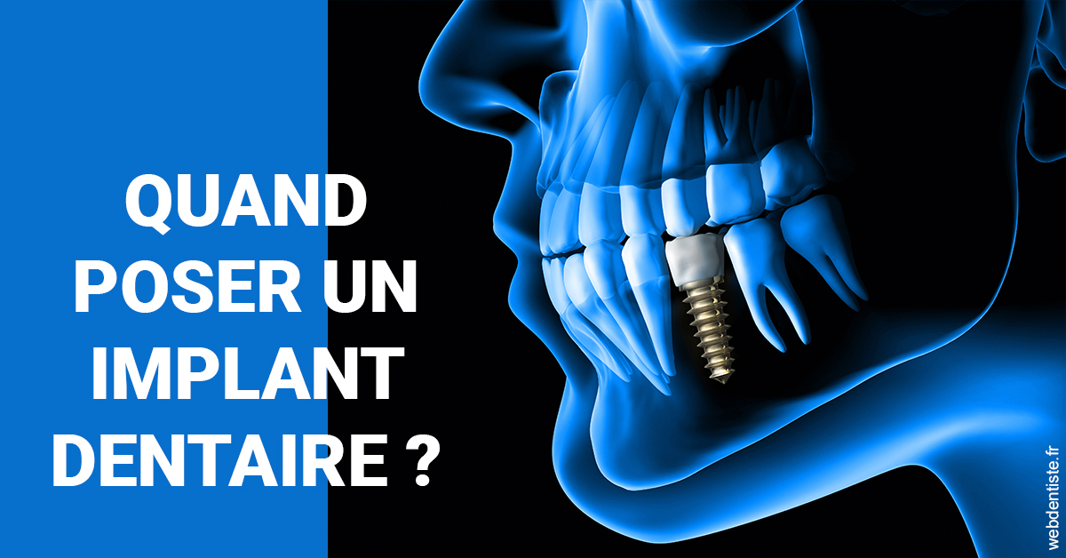 https://www.drlaparra.fr/Les implants 1